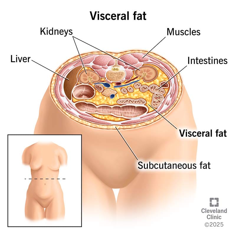 visceral fat.jpg